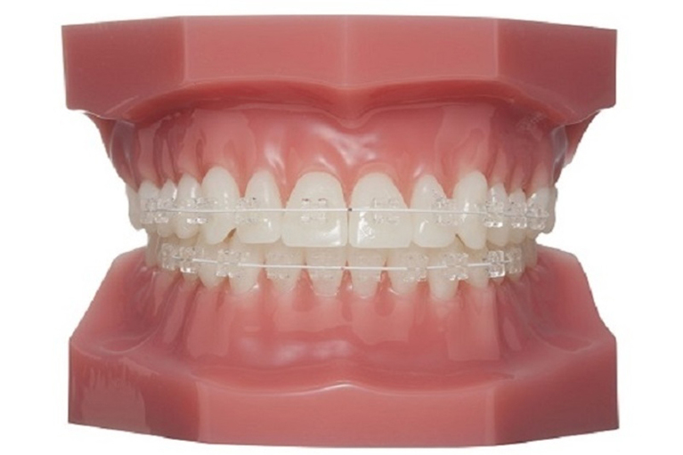 高いレベルの矯正治療を行っています